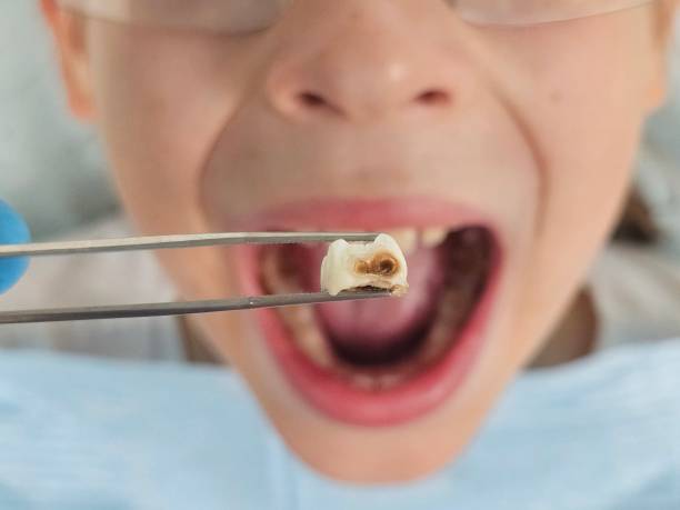 Best Urgent Dental Care for Toothaches in Luck, WI